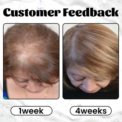 flysmus™ RevitaGinger Hair Boost Shampoo Bar