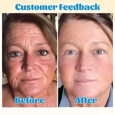 Furzero™ Hyalu B5 Pure Anti-Aging Face Serum