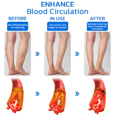 Fivfivgo™ Turmeric Varicose Vein Patch