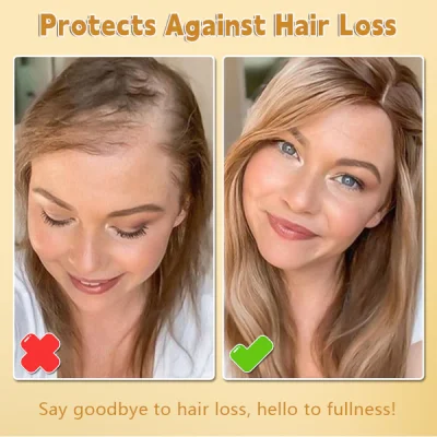 Lotmay™ Biotin Premium Hair Growth Serum. Lovilds™ Biotin Premium Hair Growth Serum