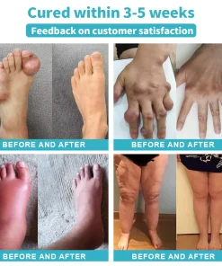 Croaie™ Nerve Relief Lotion