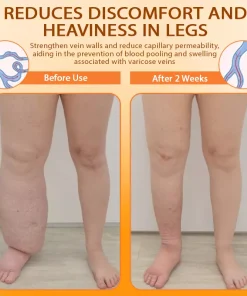 EdemaCare™ ApisVenom DrainageBody Cream