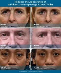 Fivfivgo™ Rapid Reduction Serum