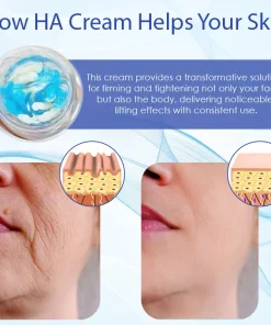 HZA™ Deep Elastic SkinRenew HA Cream
