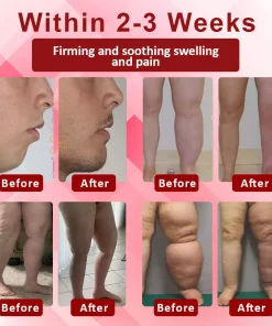 HZA™ EdemaSupport Lymphatic Drainage Massage Cream