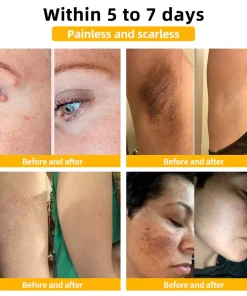 Lotmay™ Bee Venom Skin Treatment Cream