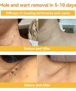 Lotmay™ Bee Venom Skin Treatment Cream