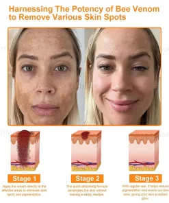 Lotmay® Multi-Function All-in-One Quick Repair Skin Treatment Cream