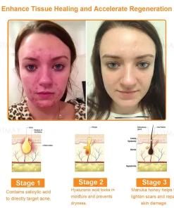 Lotmay® Multi-Function All-in-One Quick Repair Skin Treatment Cream