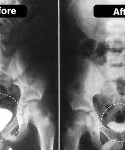 Oveallgo™ TitaniumMag Wellness Bracelet