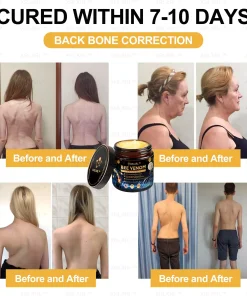 XRLXRL™ Bee Venom Pain Relief Bone Healing Cream