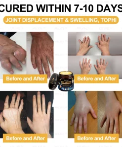 XRLXRL™ Bee Venom Pain Relief Bone Healing Cream