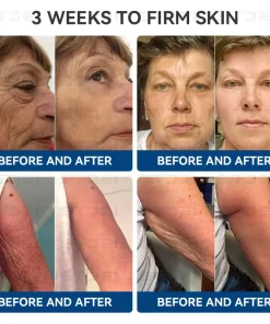 𝐒𝐓𝐃𝐄𝐈™ 𝐂𝐨𝐥𝐥𝐚𝐠𝐞𝐧 𝐏𝐞𝐩𝐭𝐢𝐝𝐞𝐬 𝐅𝐈𝐑𝐌𝐈𝐍𝐆 𝐒𝐄𝐑𝐔𝐌 𝐒𝐓𝐈𝐂𝐊