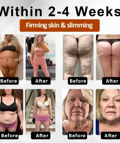 ApisDerm™ VenomDetox Moisturizing FirmingCream