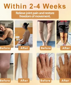 ApisHeal™ ApisVenom Turmeric Joint Healing Cream