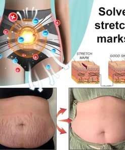 Baicloud™ Micro-Vibration Self-Heating Tourmaline Shaping Shorts