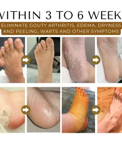 Biancat™ DetoxSculpt Bee Venom 30-Herb Foot Soak Beads