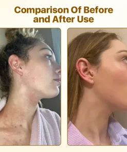 Biancat™ PureVenom Skin Revitalizing Cream