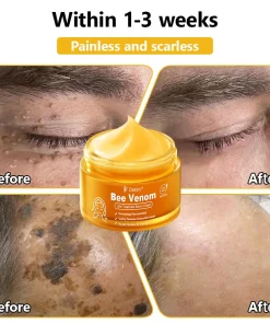 Daasry® 𝑩𝒆𝒆 𝑽𝒆𝒏𝒐𝒎 𝑺𝒌𝒊𝒏 𝑻𝒓𝒆𝒂𝒕𝒎𝒆𝒏𝒕 𝑺𝒆𝒓𝒖𝒎 𝑪𝒓𝒆𝒂𝒎