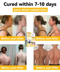 Fivfivgo™ Bee Venom & Turmeric Arthristis Treatment Gel