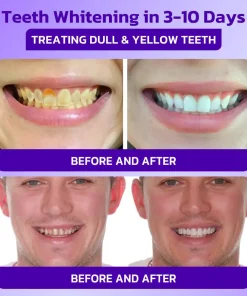 Furzero™ IntelligeSmile Mineral Fluoride-Free Toothpaste