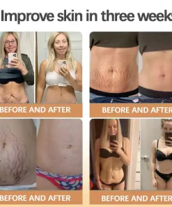 Furzero™ RolliLift Bee Venom Firming Cream