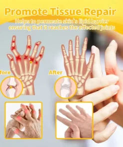 HOOMWELL™ Bee-Venom Pain-Relief Bone Healing Cream