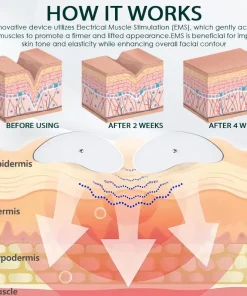 LOVILDS™LymphSculpt MicroPulse Face Massager
