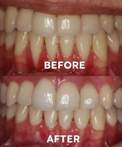 Ourlyard™ Teeth Restoration Mineral Powder