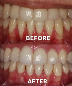 Ourlyard™ Tooth Health Mineral Powder