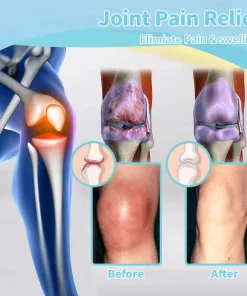 SIE𝖭𝖮𝖵𝖠™ Portable Lymphatic Detox And Joint Relaxation Therapy Device