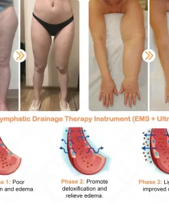 SIE𝖭𝖮𝖵𝖠™ Portable Lymphatic Detox And Joint Relaxation Therapy Device