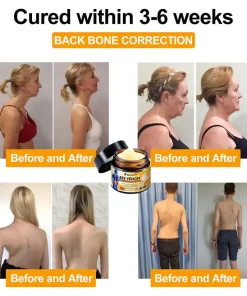 Seurico™ Bee Venom Joint and Bone Arthritis Therapy Cream