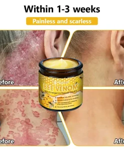 Tnnedey™ Bee Venom Skin Emergency Rescue Cream