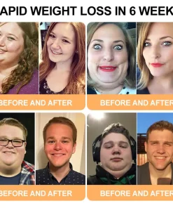 𝐓𝐎𝐎𝐘𝐄𝐒® 𝐋𝐢𝐫𝐚𝐠𝐥𝐮𝐭𝐢𝐝𝐞 𝐆𝐋𝐏-𝟏 𝐇𝐞𝐫𝐛𝐚𝐥 𝐎𝐫𝐚𝐥 𝐋𝐢𝐪𝐮𝐢𝐝