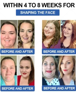 𝐓𝐨𝐨𝐲𝐞𝐬™ 𝐓𝐢𝐫𝐳𝐞𝐩𝐚𝐭𝐢𝐝𝐞 𝐆𝐋𝐏-𝟏 𝐇𝐞𝐫𝐛𝐚𝐥 𝐎𝐫𝐚𝐥 𝐋𝐢𝐪𝐮𝐢𝐝