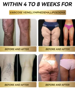 𝑭𝑨𝑻𝑶𝑵𝑮™👩‍⚕️🎁 𝑮𝑳𝑷-1 𝑶𝒓𝒂𝒍 𝑳𝒊𝒒𝒖𝒊𝒅 𝑺𝒖𝒑𝒑𝒍𝒆𝒎𝒆𝒏𝒕