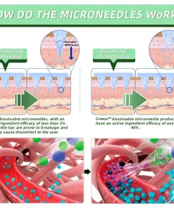 𝗖𝘃𝗿𝗲𝗼𝘇™ SMGT-GLP-1 Nano Microneedle Patch