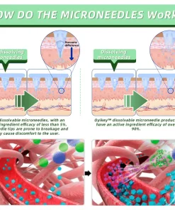 0yikey™ SMGT-GLP-1 Nano Microneedle Patch