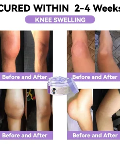 ADFIRE™ 7 Day! Joint & Bone Therapy Cream