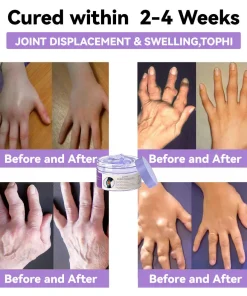 ADFIRE™ 7 Day! Joint & Bone Therapy Cream