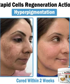 ADFIRE™ Bee Venom Multi-Symptom Skin Treatment Cream