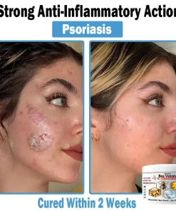 ADFIRE™ Bee Venom Multi-Symptom Skin Treatment Cream