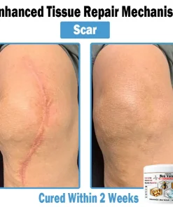 ADFIRE™ Bee Venom Multi-Symptom Skin Treatment Cream