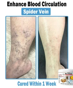 ADFIRE™ Bee Venom Multi-Symptom Skin Treatment Cream