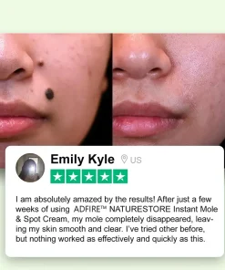 ADFIRE™ NATURESTORE