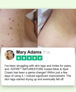 ADFIRE™ NATURESTORE