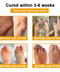 ADNOON™ Botulinum Toxin & Bee Venom Pain-Relief Bone Healing Cream