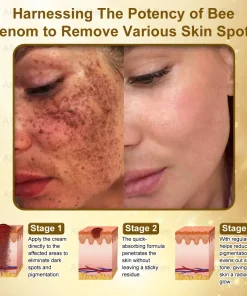 AllyBee® Botox Skin Treatment Cream