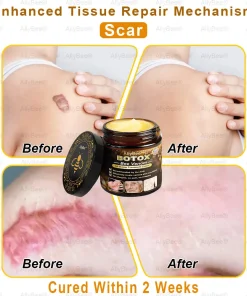 AllyBee® Botox Skin Treatment Cream